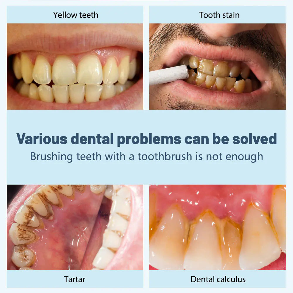 Ultrasonic Electric Tooth Plaque Removal Cleaner