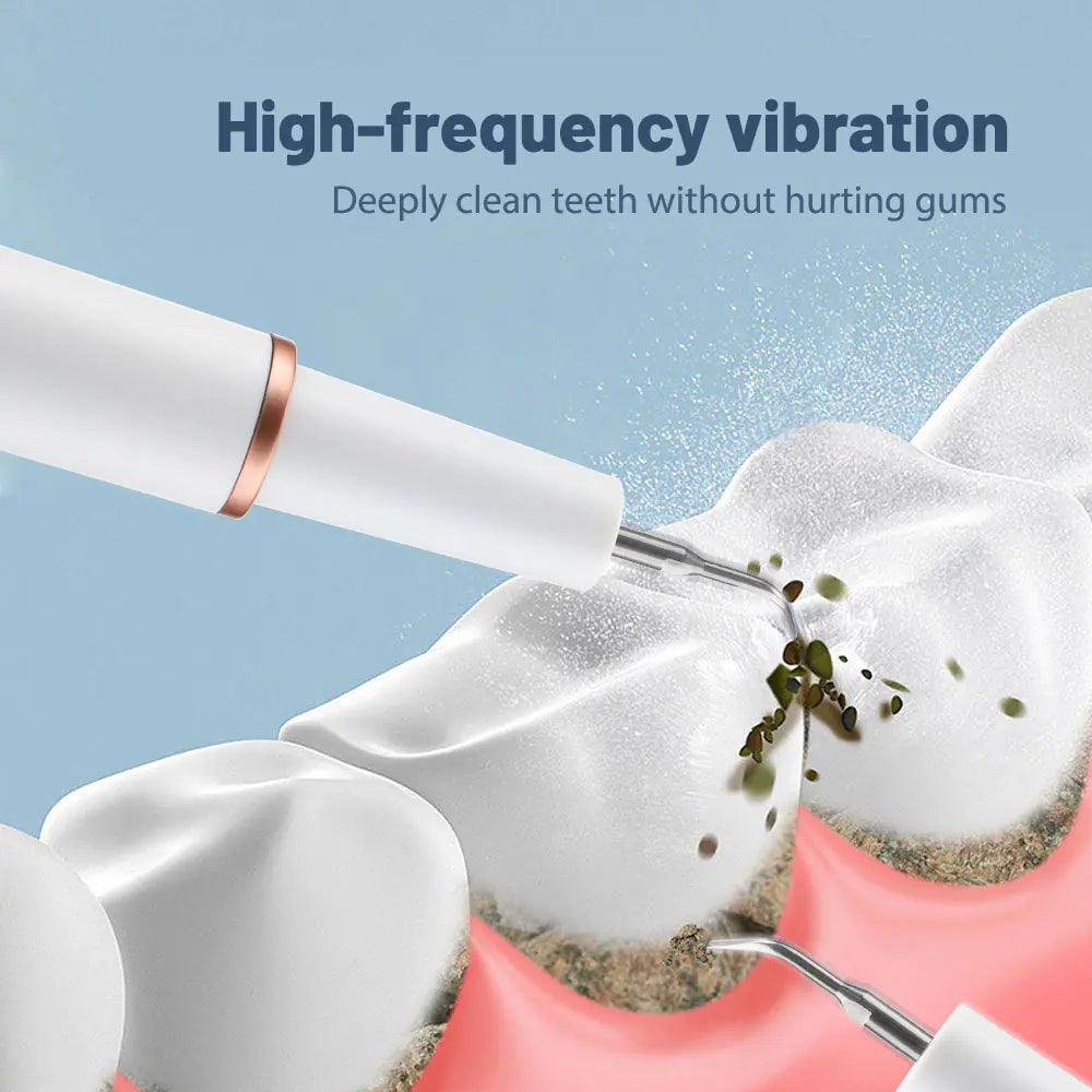Ultrasonic Electric Tooth Plaque Removal Cleaner