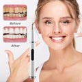 Ultrasonic Electric Tooth Plaque Removal Cleaner